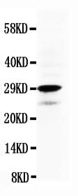 Anti-Calretinin/CALB2 Antibody Picoband® Boster Bio