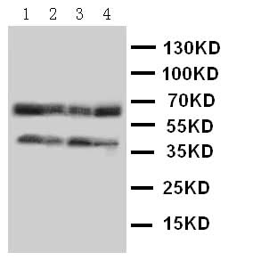 Anti-C-C chemokine receptor type 5 CCR5 Antibody Picoband® Boster Bio