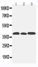 Anti-C-C chemokine receptor type 5 CCR5 Antibody Picoband® Boster Bio