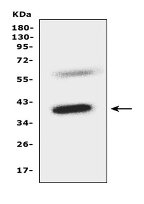 Anti-C-C chemokine receptor type 5 CCR5 Antibody Picoband® Boster Bio
