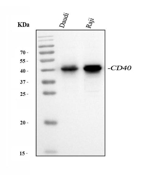 Anti-CD40 Antibody Picoband® Boster Bio