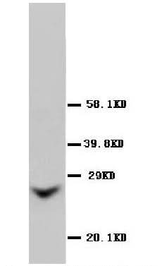Anti-Gap junction beta-2 protein GJB2 Antibody Picoband® Boster Bio