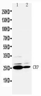 Anti-C Reactive Protein/CRP Antibody Picoband® Boster Bio