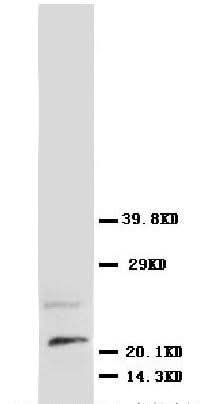 Anti-Beta-nerve growth factor NGF Antibody Picoband® Boster Bio