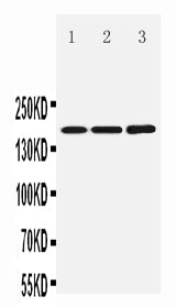 Anti-NMDAR2B/GRIN2B Antibody Picoband® Boster Bio