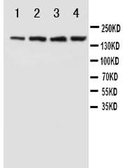 Anti-NMDAR2B/GRIN2B Antibody Picoband® Boster Bio