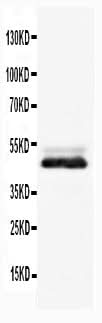 Anti-NSE/ENO2 Antibody Picoband® Boster Bio