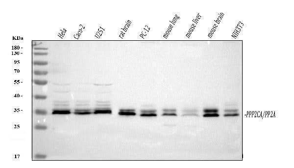 Anti-PP2A-alpha/PPP2CA Antibody Picoband® Boster Bio