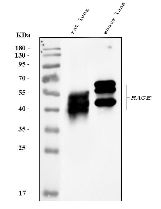 Anti-RAGE/AGER Antibody Picoband® Boster Bio