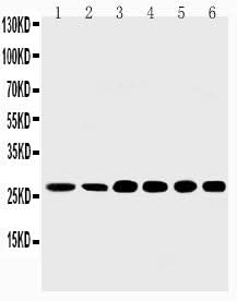 Anti-Sonic Hedgehog/SHH Antibody Picoband® Boster Bio