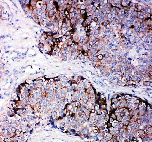 Anti-Metalloproteinase inhibitor 2 TIMP2 Antibody Boster Bio