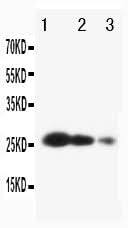 Anti-Metalloproteinase inhibitor 3 TIMP3 Antibody Picoband® Boster Bio