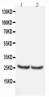Anti-Metalloproteinase inhibitor 4 TIMP4 Antibody Picoband® Boster Bio