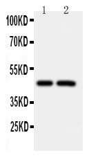 Anti-Caspase-2/CASP2 Antibody Picoband® Boster Bio
