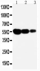 Anti-Fas Antibody Picoband® Boster Bio