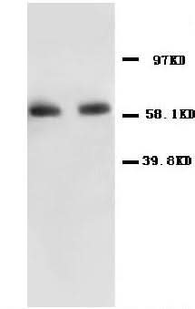 Anti-NF-kB p65/RELA Antibody Picoband® Boster Bio