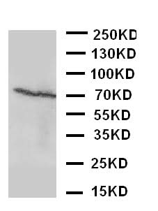 Anti-Estrogen Receptor beta/ESR2 Antibody Picoband® Boster Bio