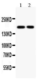 Anti-Topoisomerase II alpha/TOP2A Antibody Picoband® Boster Bio