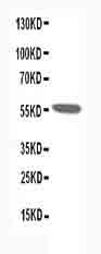 Anti-Nicotinic Acetylcholine Receptor alpha 1/CHRNA1 Antibody Picoband® Boster Bio