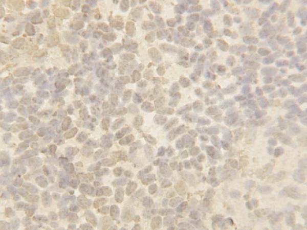 Anti-Cullin 4B/CUL4B Antibody Picoband® Boster Bio