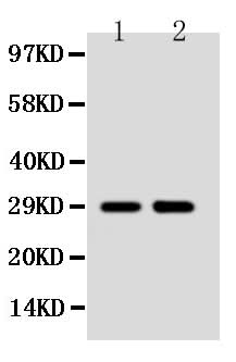 Anti-Protein SSX2 SSX2 Antibody Picoband® Boster Bio