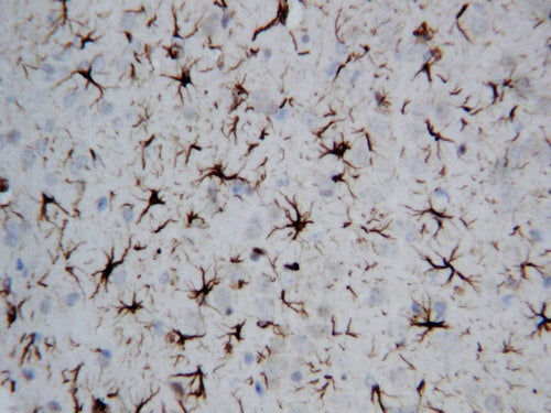 Anti-GFAP Antibody Picoband® Boster Bio