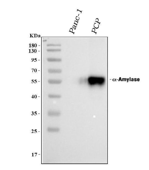 Anti-Alpha Amylase 1/AMY1A Antibody Picoband® Boster Bio
