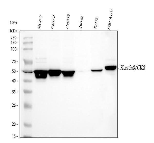 Anti-Cytokeratin 8/KRT8 Antibody Picoband® Boster Bio
