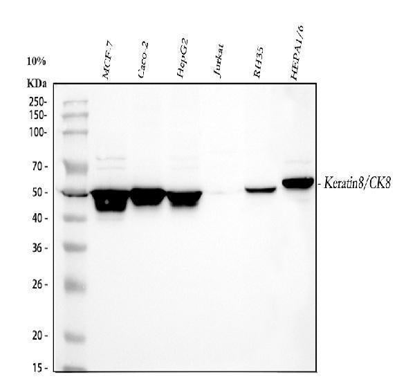 Anti-Cytokeratin 8/KRT8 Antibody Picoband® Boster Bio