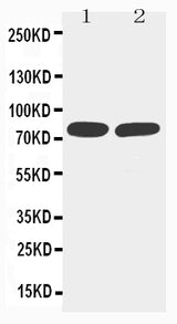 Anti-TNF Receptor II/TNFRSF1B Antibody Picoband® Boster Bio