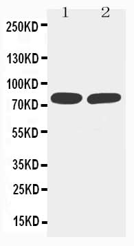 Anti-TNF Receptor II/TNFRSF1B Antibody Picoband® Boster Bio