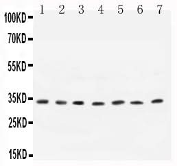 Anti-Cyclin D1/CCND1 Antibody Picoband® Boster Bio