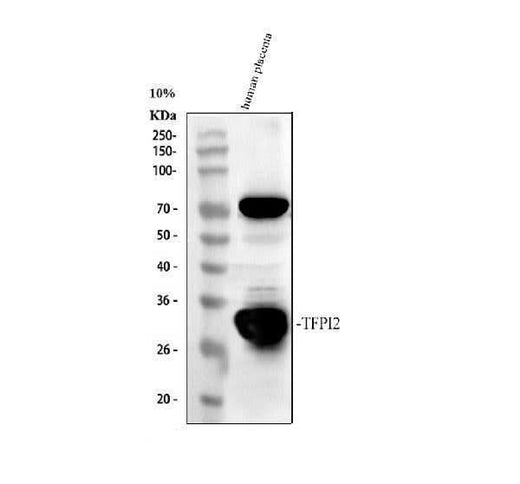 Anti-TFPI2 Antibody Picoband® Boster Bio