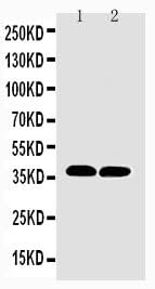 Anti-MTCO1/mt-Co1 Antibody Picoband® Boster Bio