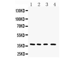 Anti-MTCO1/MT-CO1 Antibody Picoband® Boster Bio