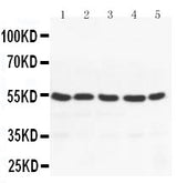 Anti-PPAR gamma/PPARG Antibody Picoband® Boster Bio