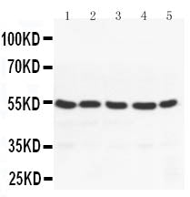 Anti-PPAR gamma/PPARG Antibody Picoband® Boster Bio