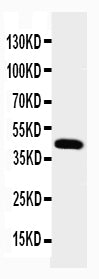 Anti-Podocin NPHS2 Antibody Picoband® Boster Bio