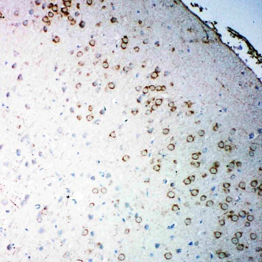 Anti-Muscarinic Acetylcholine Receptor 2/CHRM2 Antibody Picoband® Boster Bio