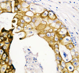Anti-Cytokeratin 19/KRT19 Antibody Picoband® Boster Bio