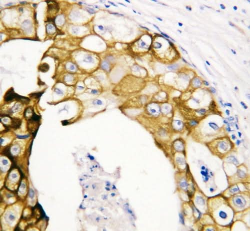 Anti-Cytokeratin 19/KRT19 Antibody Picoband® Boster Bio