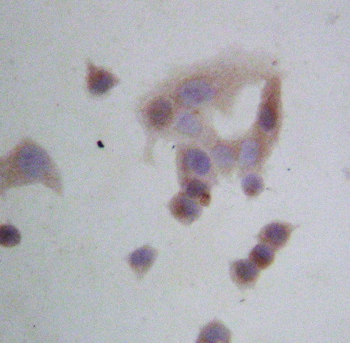 Anti-GRP94/HSP90B1 Antibody Picoband® Boster Bio