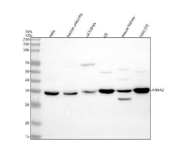 Anti-Annexin A2/ANXA2 Antibody Picoband® Boster Bio