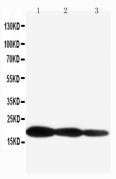 Anti-IL1 beta/IL1B Antibody Picoband® Boster Bio