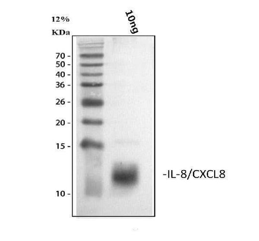 Anti-IL8/CXCL8 Antibody Picoband® Boster Bio