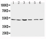 Anti-Presenilin 2/PSEN2 Antibody Picoband® Boster Bio