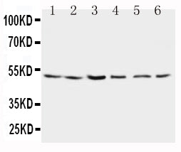 Anti-Presenilin 2/PSEN2 Antibody Picoband® Boster Bio