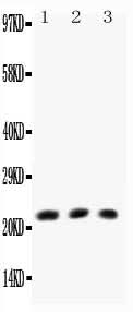 Anti-TNF beta/LTA Antibody Picoband® Boster Bio