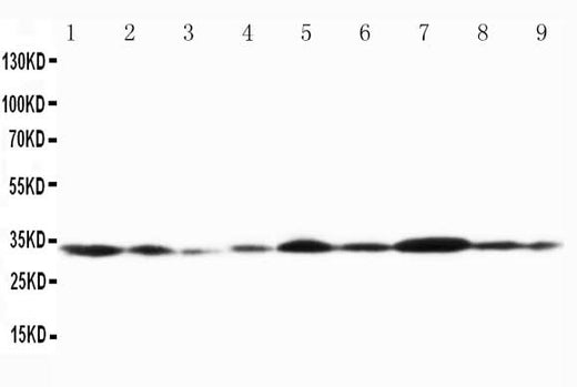Anti-Connexin 32/GJB1 Antibody Picoband® Boster Bio