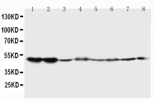 Anti-5HT2A Receptor/HTR2A Antibody Picoband® Boster Bio